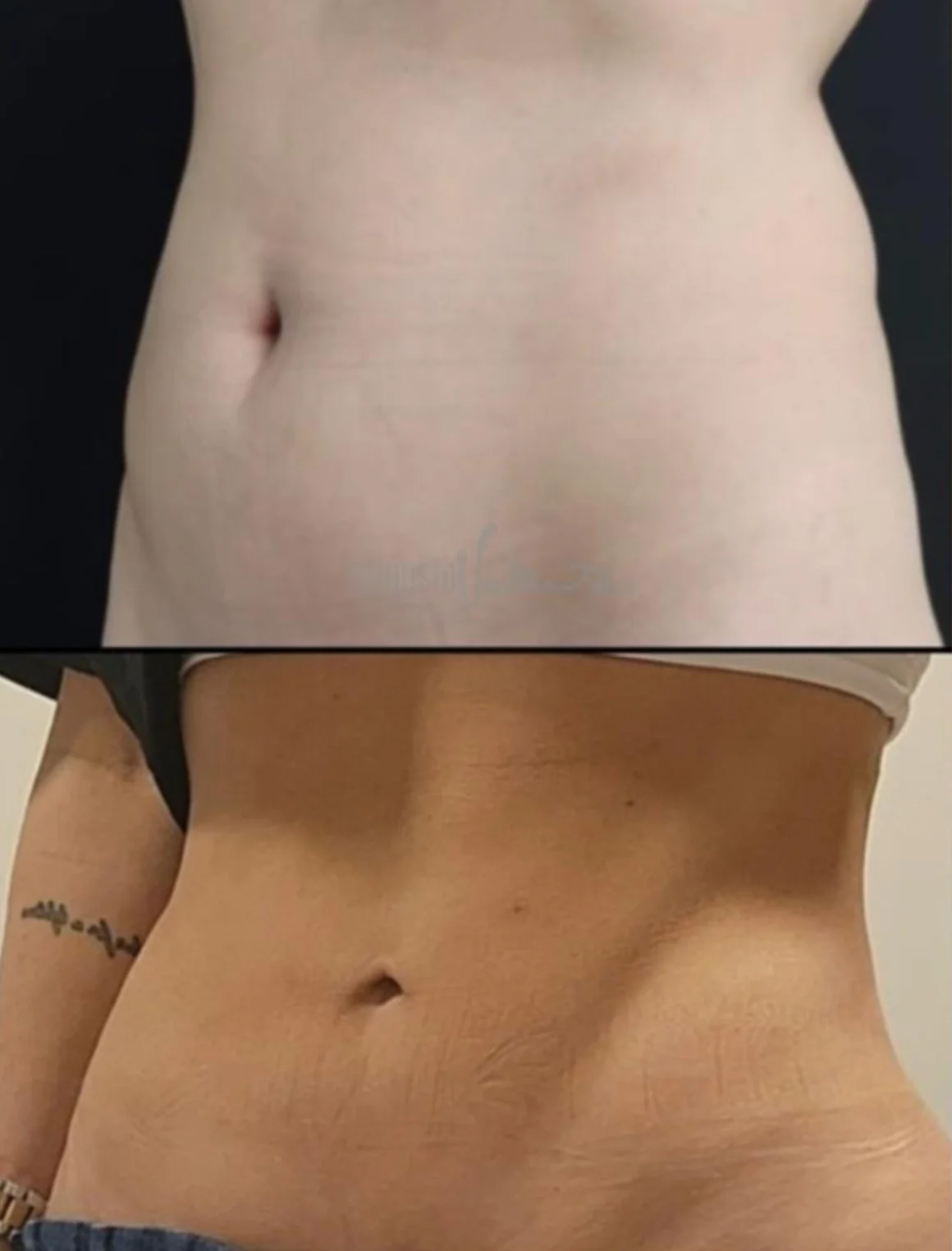 Caso 08 — antes e depois