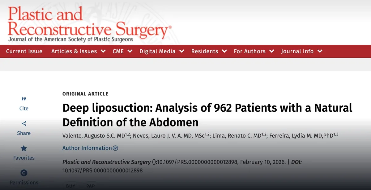 Artigo 'Deep liposuction: Analysis of 962 Patients with a Natural Definition of the Abdomen' aceito para publicação na Plastic and Reconstructive Surgery, com autores e DOI.